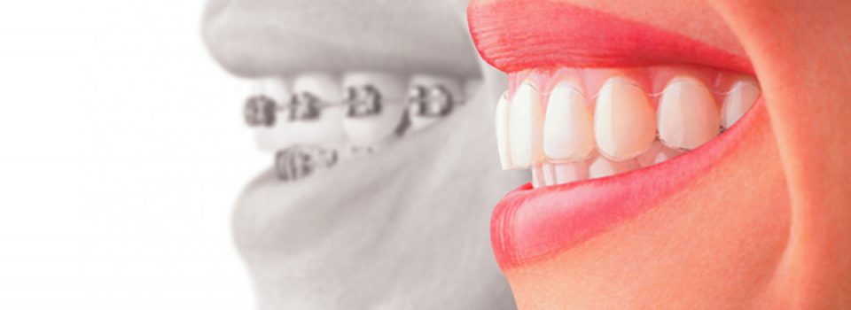 ortodoncia-31xwll55xipe5vlcvtpbls